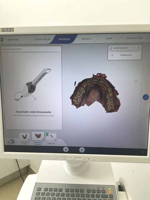 Scanner intraoral Ceres Omnicam AC