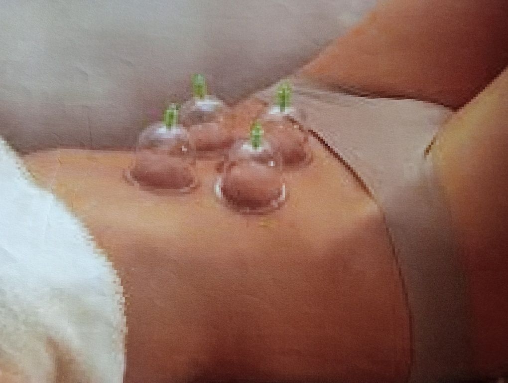 Massagem  a vácuo.