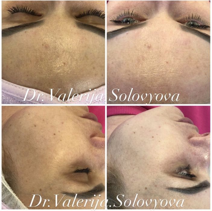 Косметолог Ужгород, інʼєкціоніст.