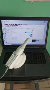 Сканер Інтраоральний стоматологічний : planscan color Planmeca