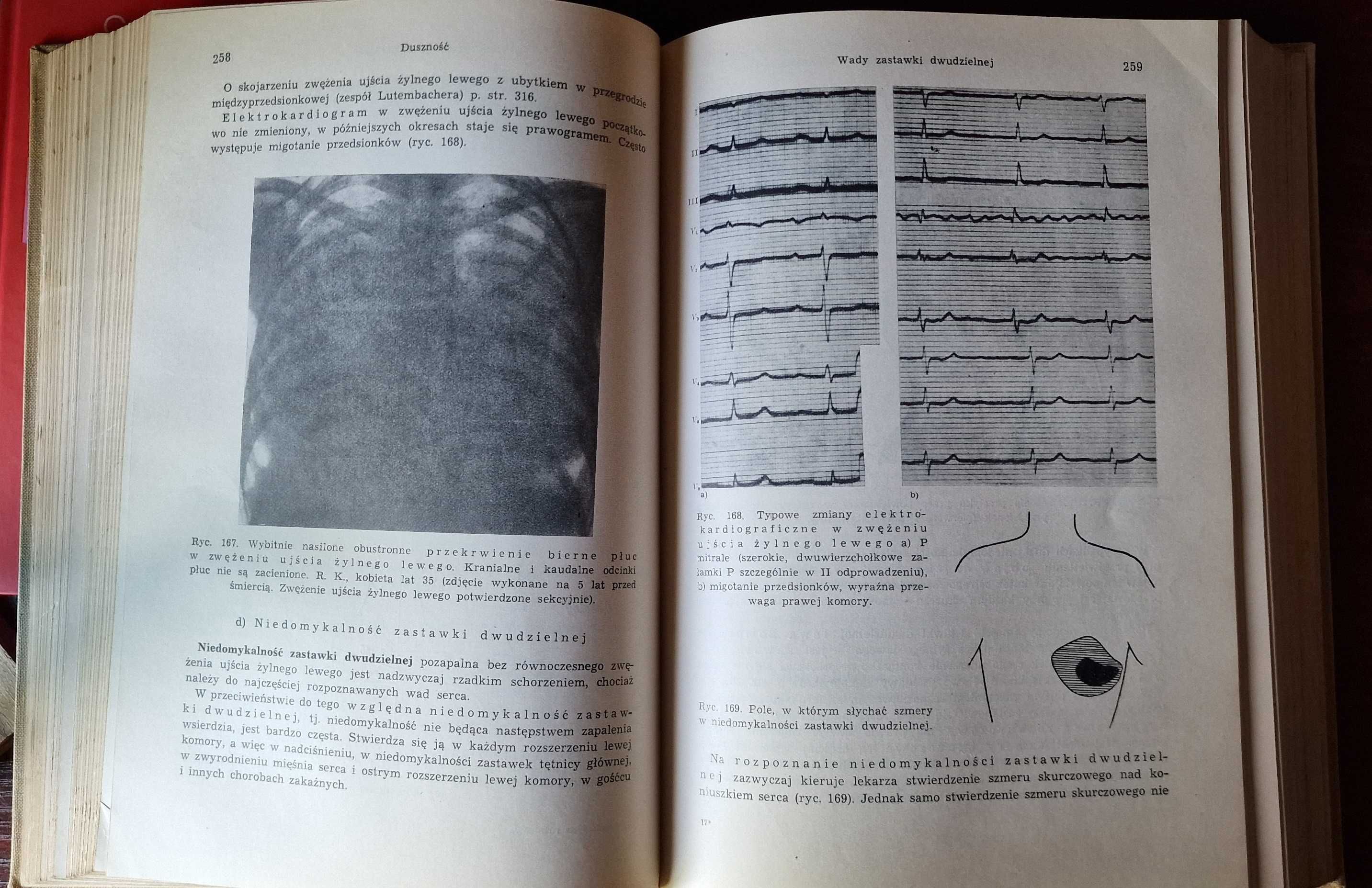Diagnostyka różnicowa w chorobach wewnętrznych Hegglin 1960 książka
