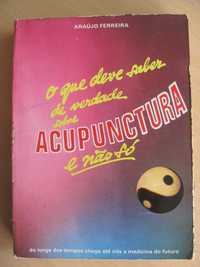 O que deve saber de verdade sobre Acupunctura e não só