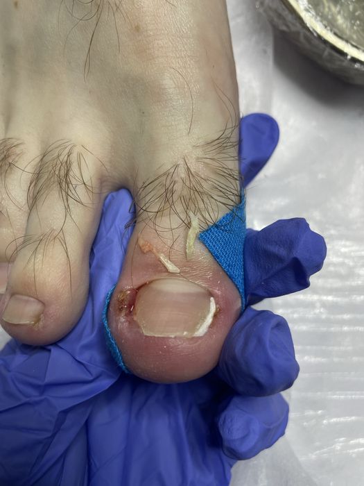 Подолог Харків, Центр. Подологічний педікюр