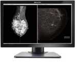 Monitor radiologiczno-diagnostyczny Beacon C81W+