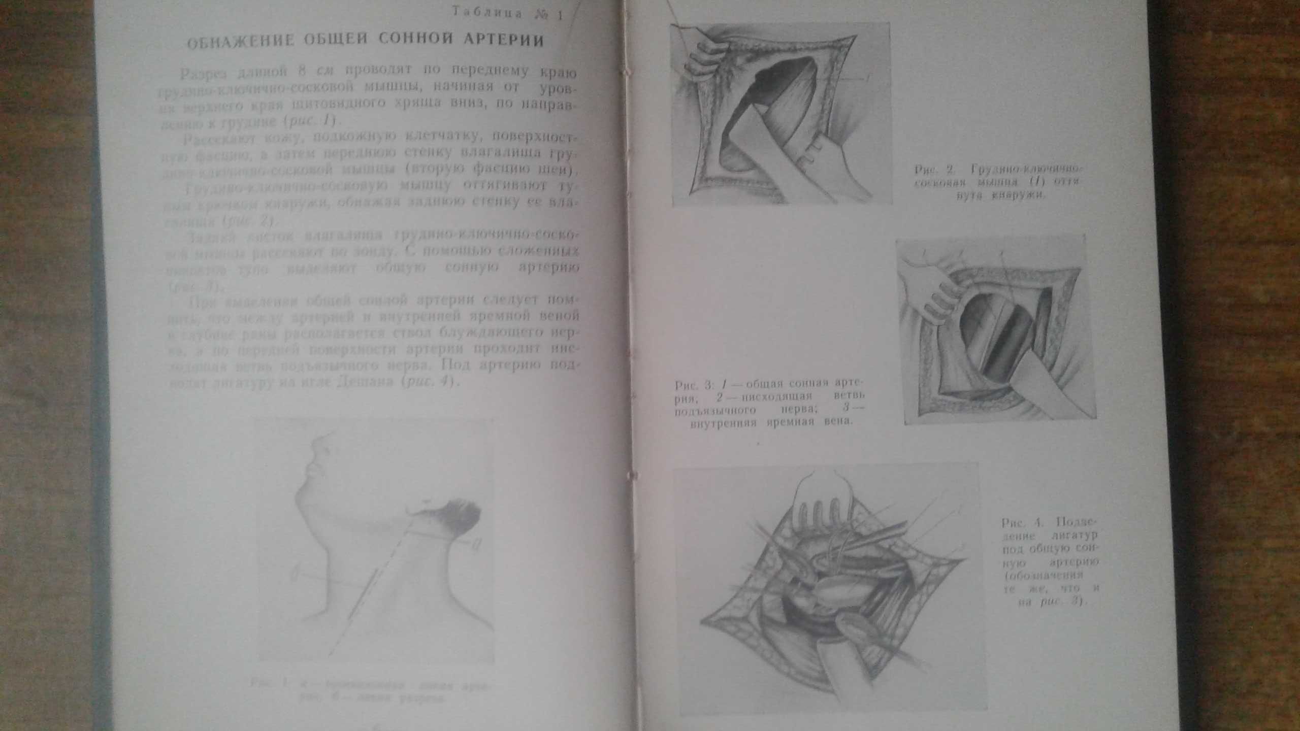 Техника хирургических операций Портативный атлас 1963 год