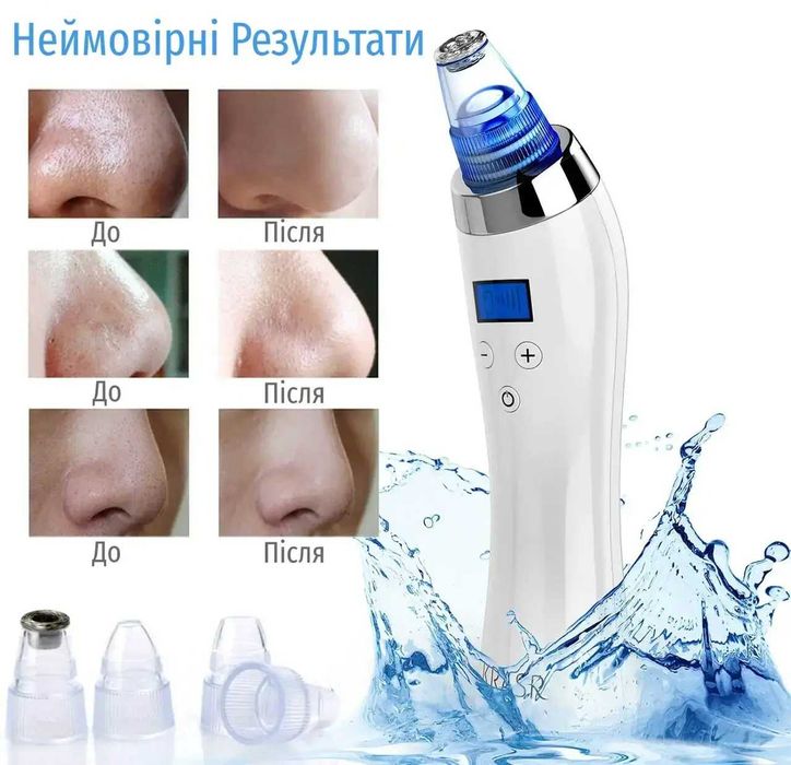 Новий  вакуумний очищувач  обличчя KRASR Comedo Suction.