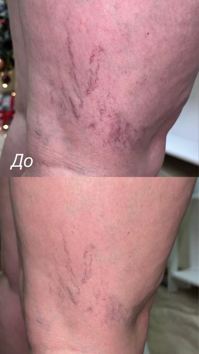 Масаж/ Обгортання/ Тейпування/ Мультимаскінг face