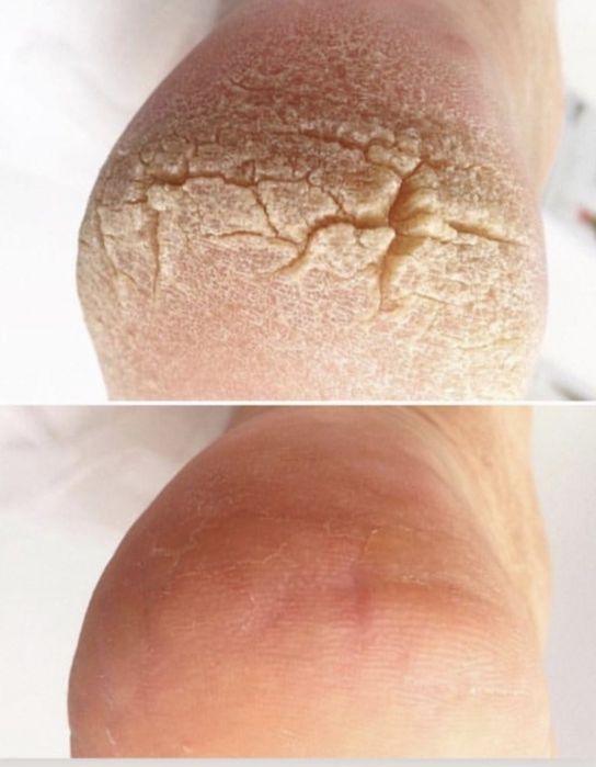 Подолог. Послуги подолога, медичний педикюр,  естетичний педикюр