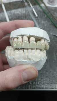 Зубний технік /зуботехнічна лабораторіїя