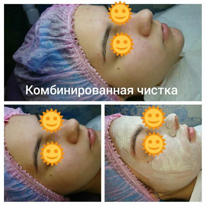 Косметолог - естетист з вищою медичною освітою, консультації по акне,