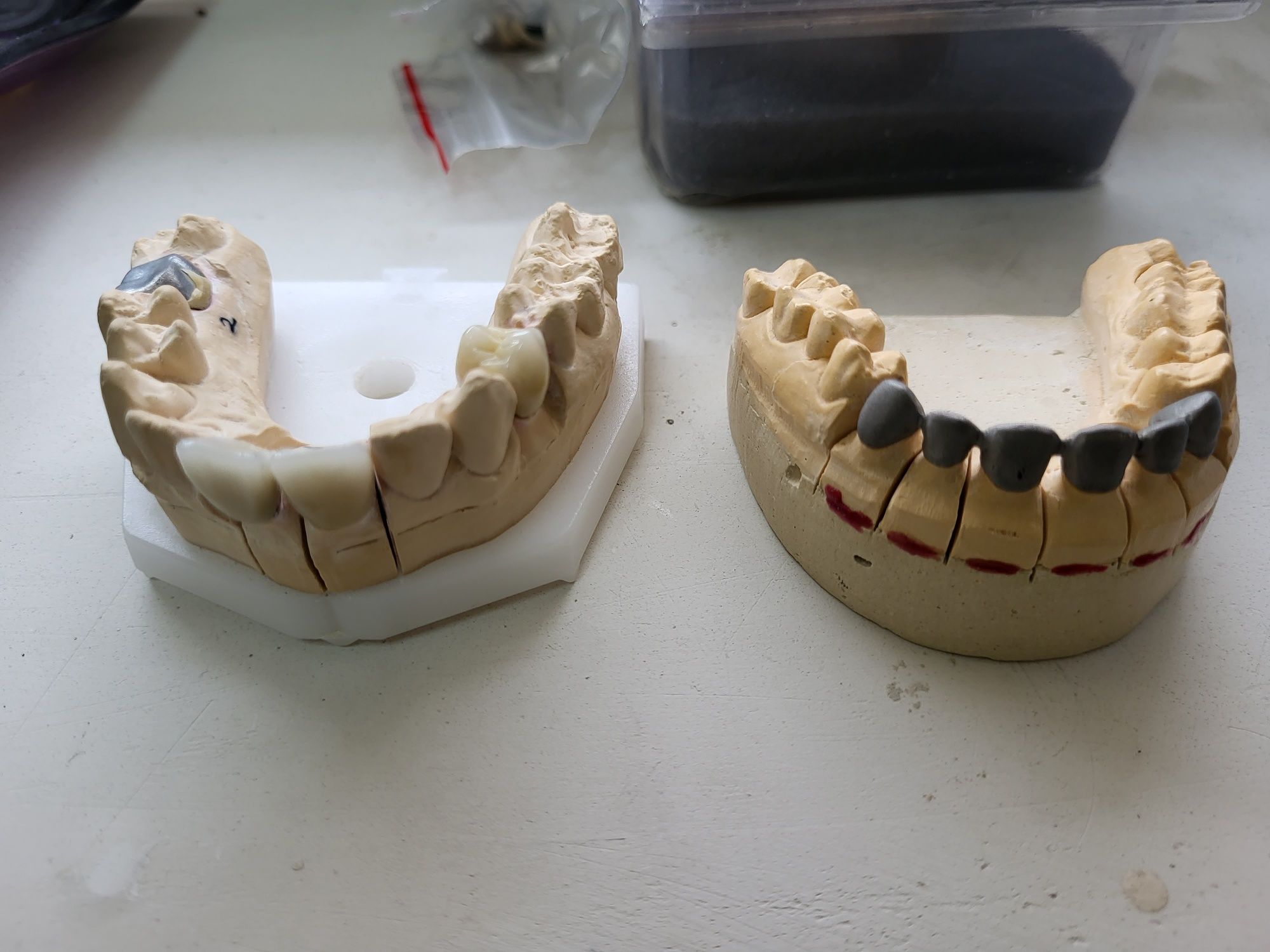 Зуби моделі зубів металокераміка