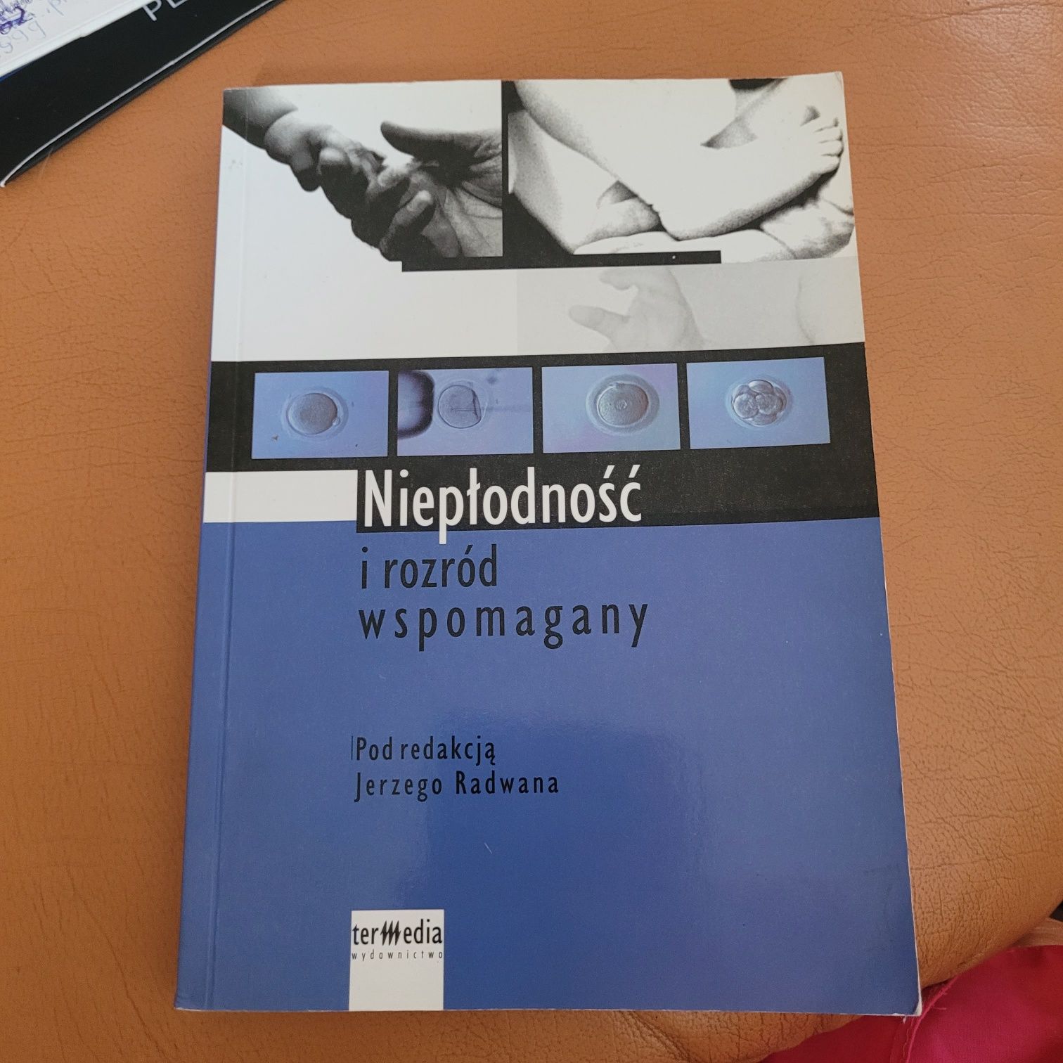 Niepłodność i rozród wspomagany J. Radwan