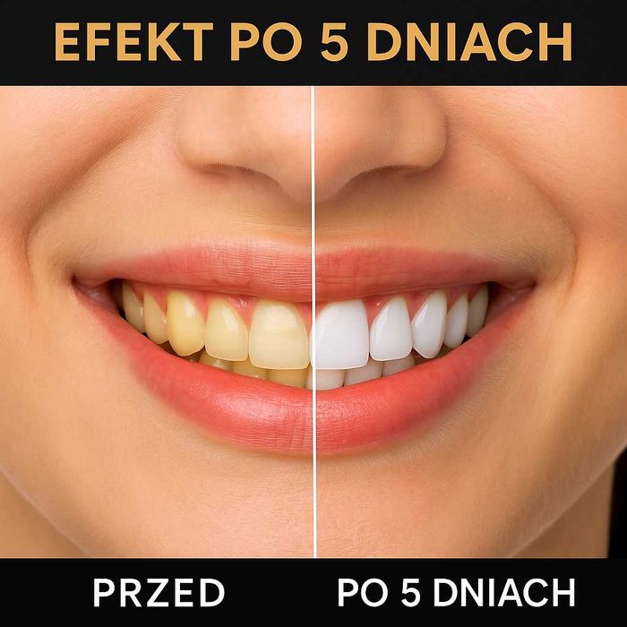 Najmocniejsze paski wybielające 40 szt. z USA  Smilumin LED CREST