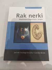 Książka 'Rak nerki. Współczesna diagnostyka i terapia'
