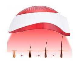 PROMOÇÃO/Capacete Laser/Parar a queda e fazer crescer novos fios