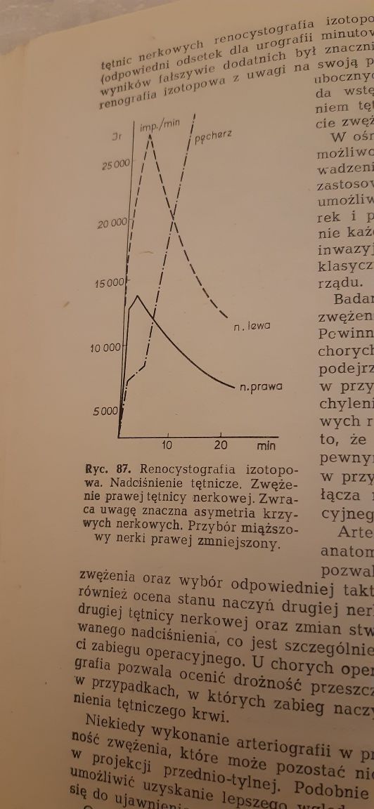 Nadciśnienie tętnicze  Włodzimierz Januszewicz