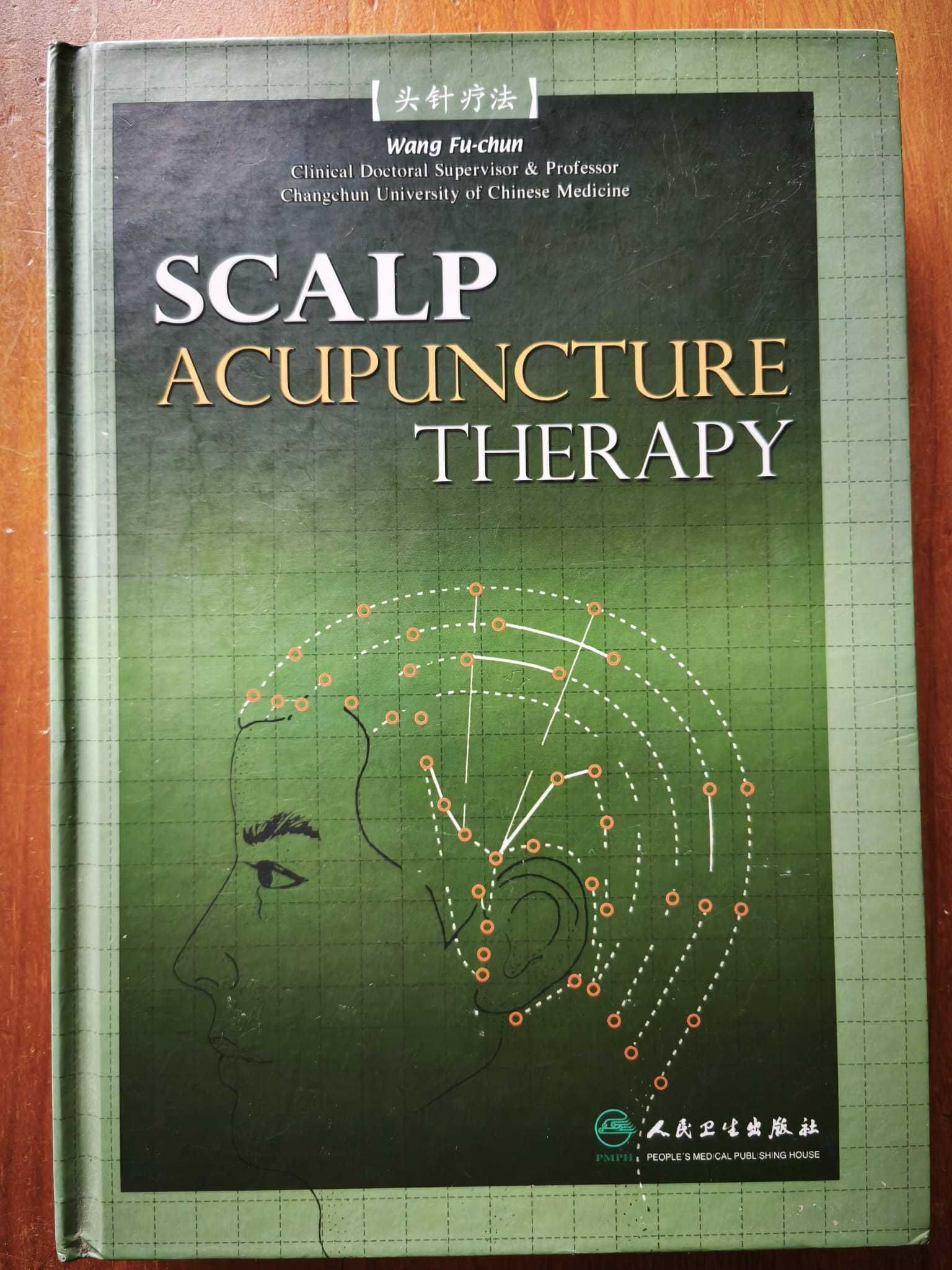 Scalp Acupuncture Therapy