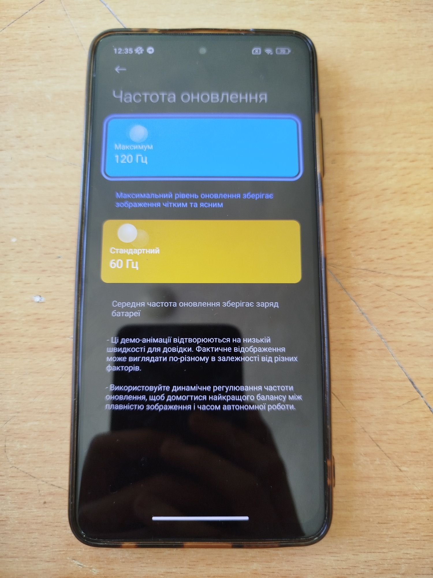 Телефон poco x3 pro