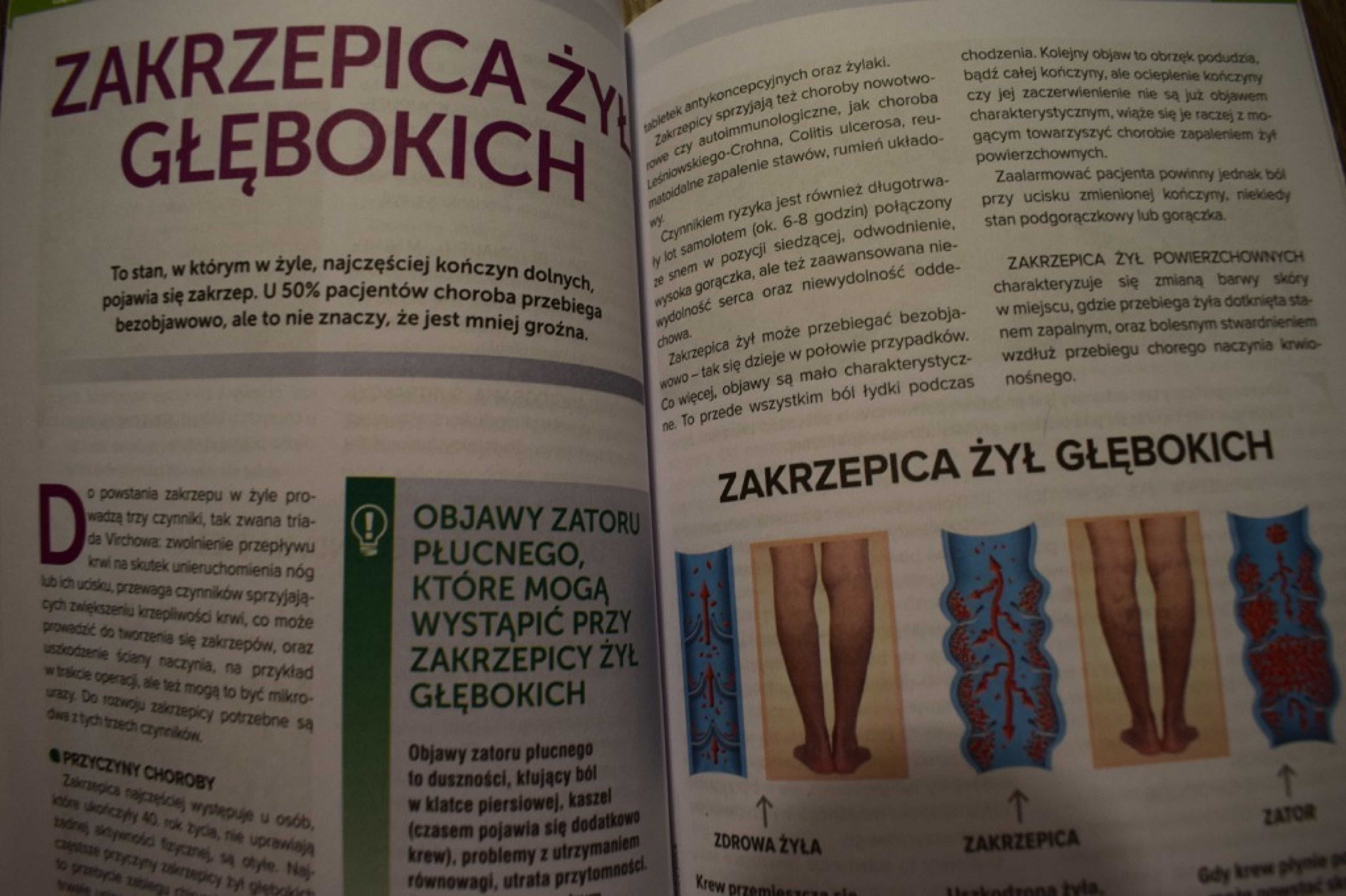 Wieńcówka ,zawał ,udar ,zakrzepica  ,arterioskleroza