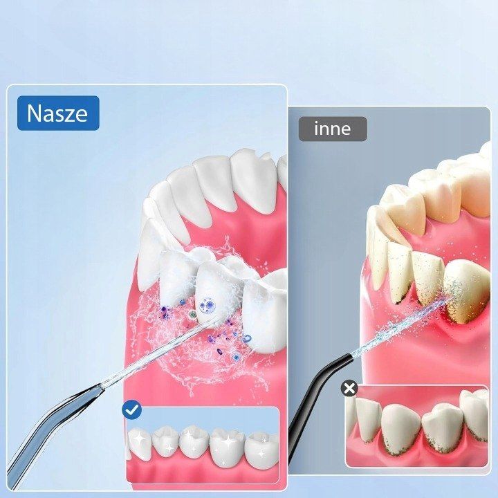 Irygator Do Zębów Bezprzewodowy Dentystyczny 4 Tryby 320Ml 8 Końcówek