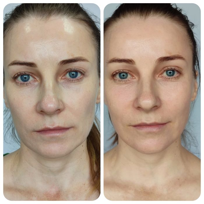 Масаж обличчя професійно