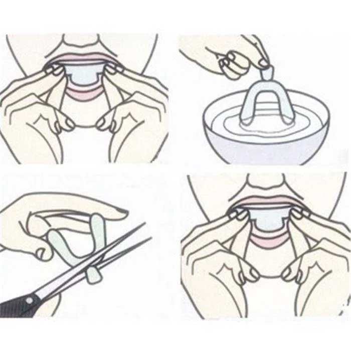 2x Protetor aparelho branqueador boca dentes anti ranger moldeiras