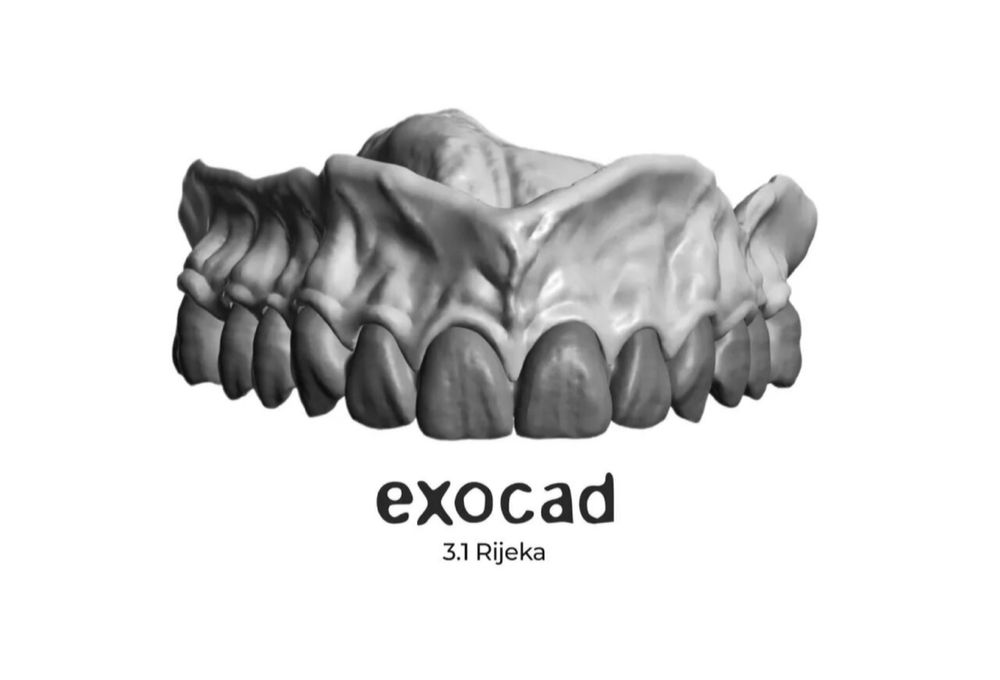 Установка Exocad 3.1 Rijeka и Exocad 2.4 Plovdiv