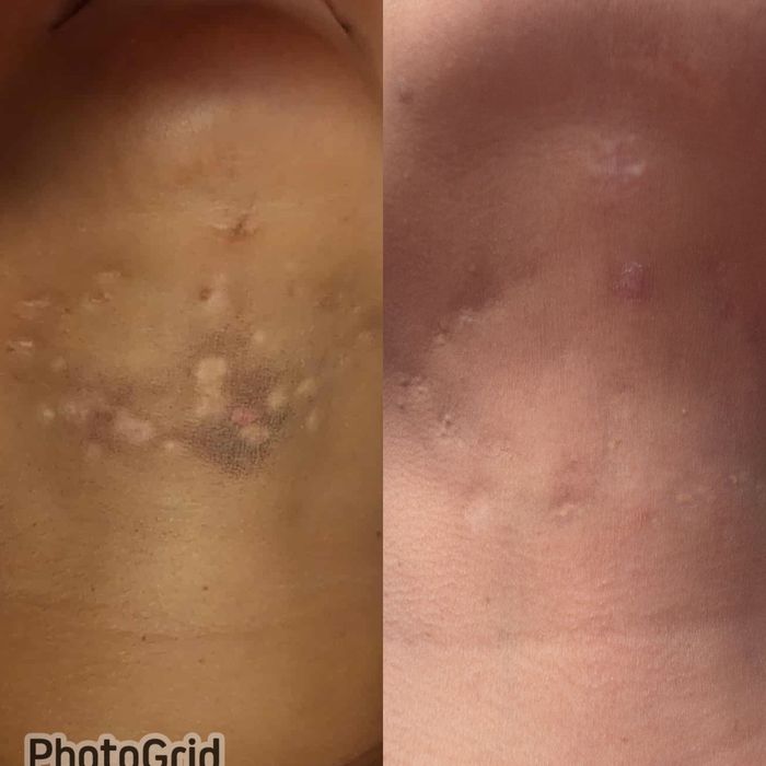 Tratamento Estético - depilação etc