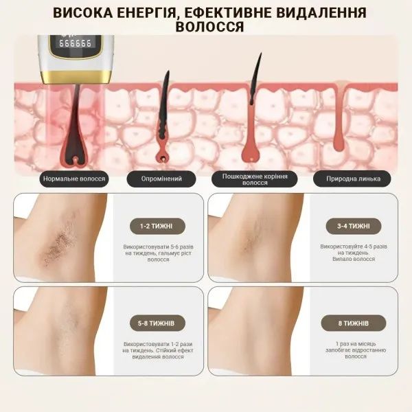 Фотоепілятор INSPIRE Sapphire XM- L011W