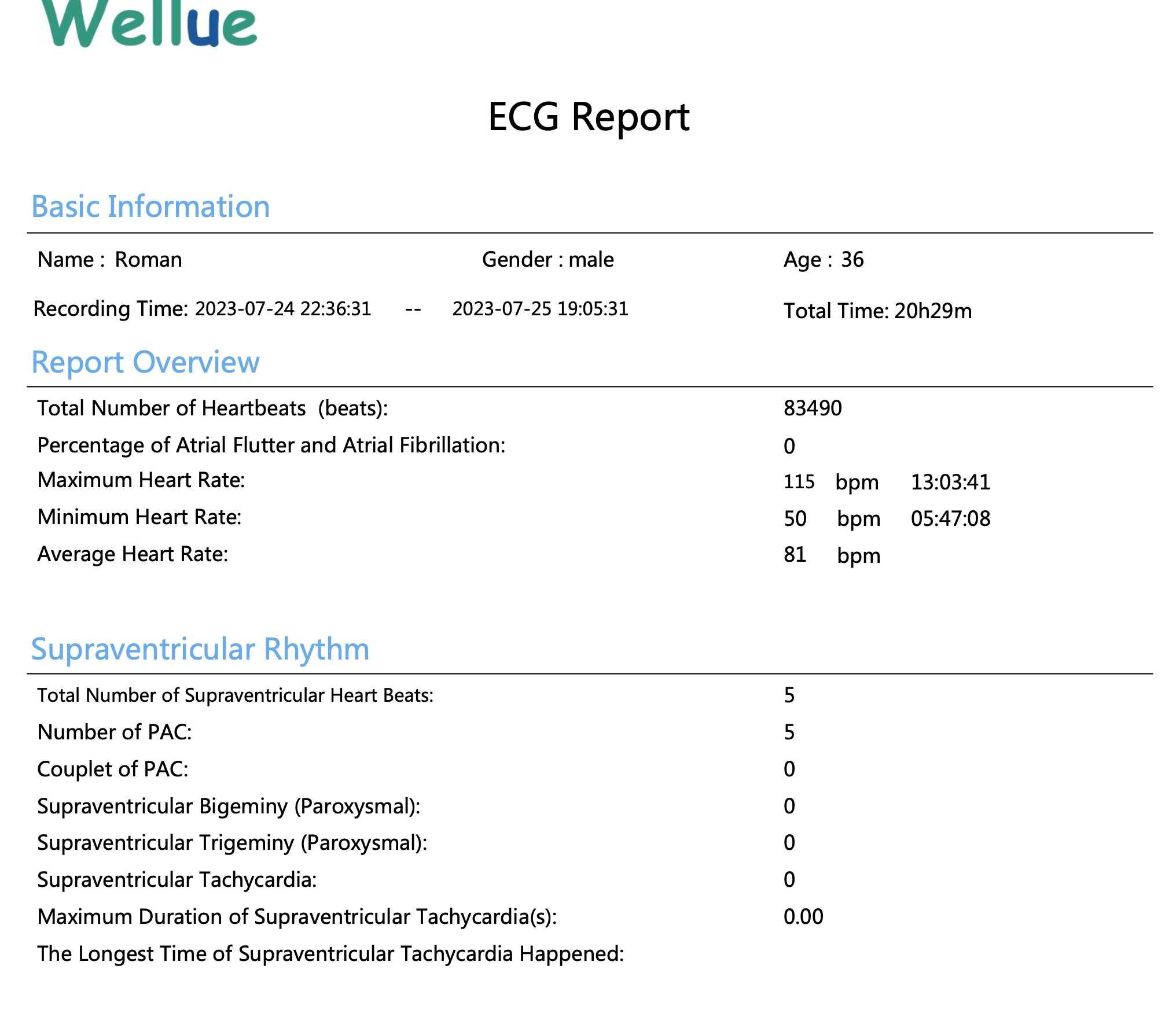 Wellue ER1 Holter EKG 24-godziny monitor z interpretacją wyników