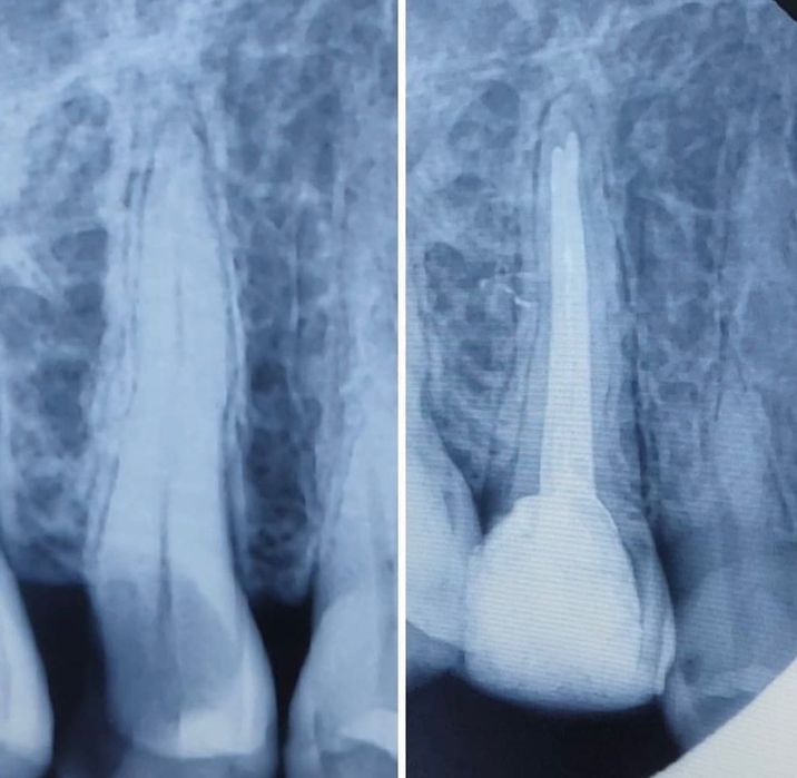 Стоматолог Одесса лечение бесплатно !