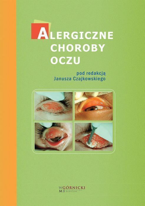 Alergiczne Choroby Oczu