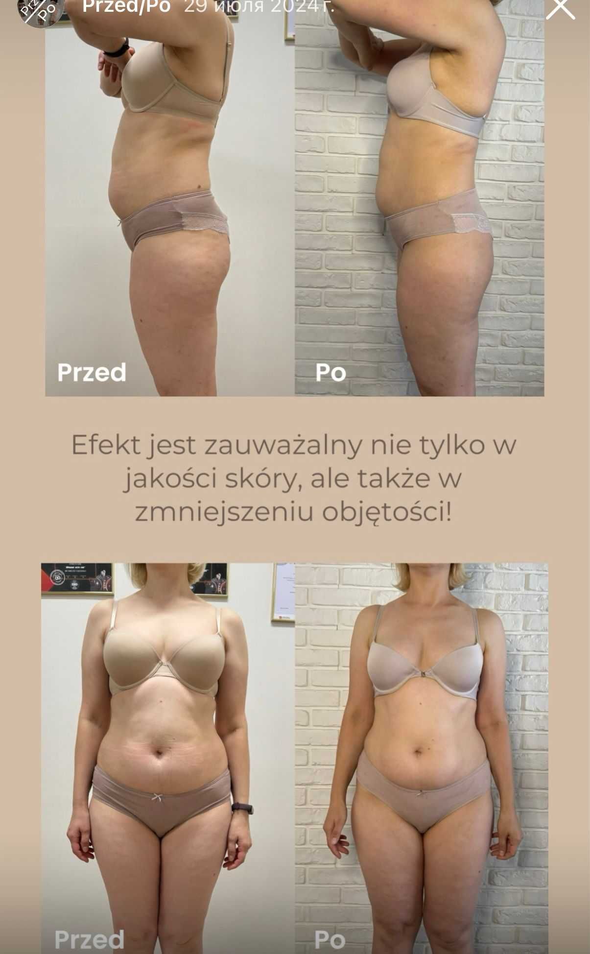Urządzenie do masażu modelującego sylwetkę Vela Shape