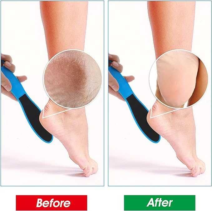 Dwustronny skrobak / pilnik do stóp x 10sztuk