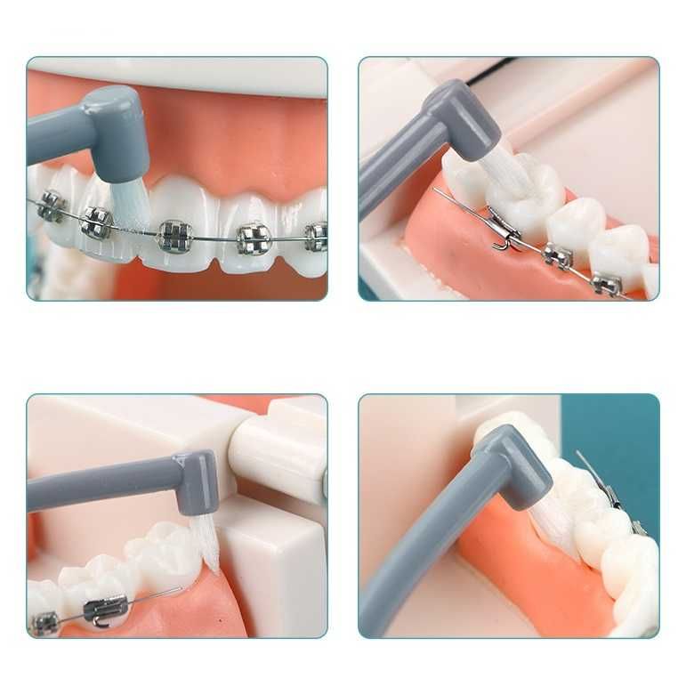 Монопучковая зубная щетка для ухода за брекетами