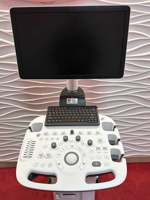 УЗД апарат (УЗИ аппарат) Samsung Medison HS30