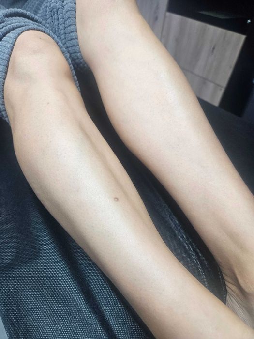 Depilacja woskiem i pastą cukrową (sugaring).