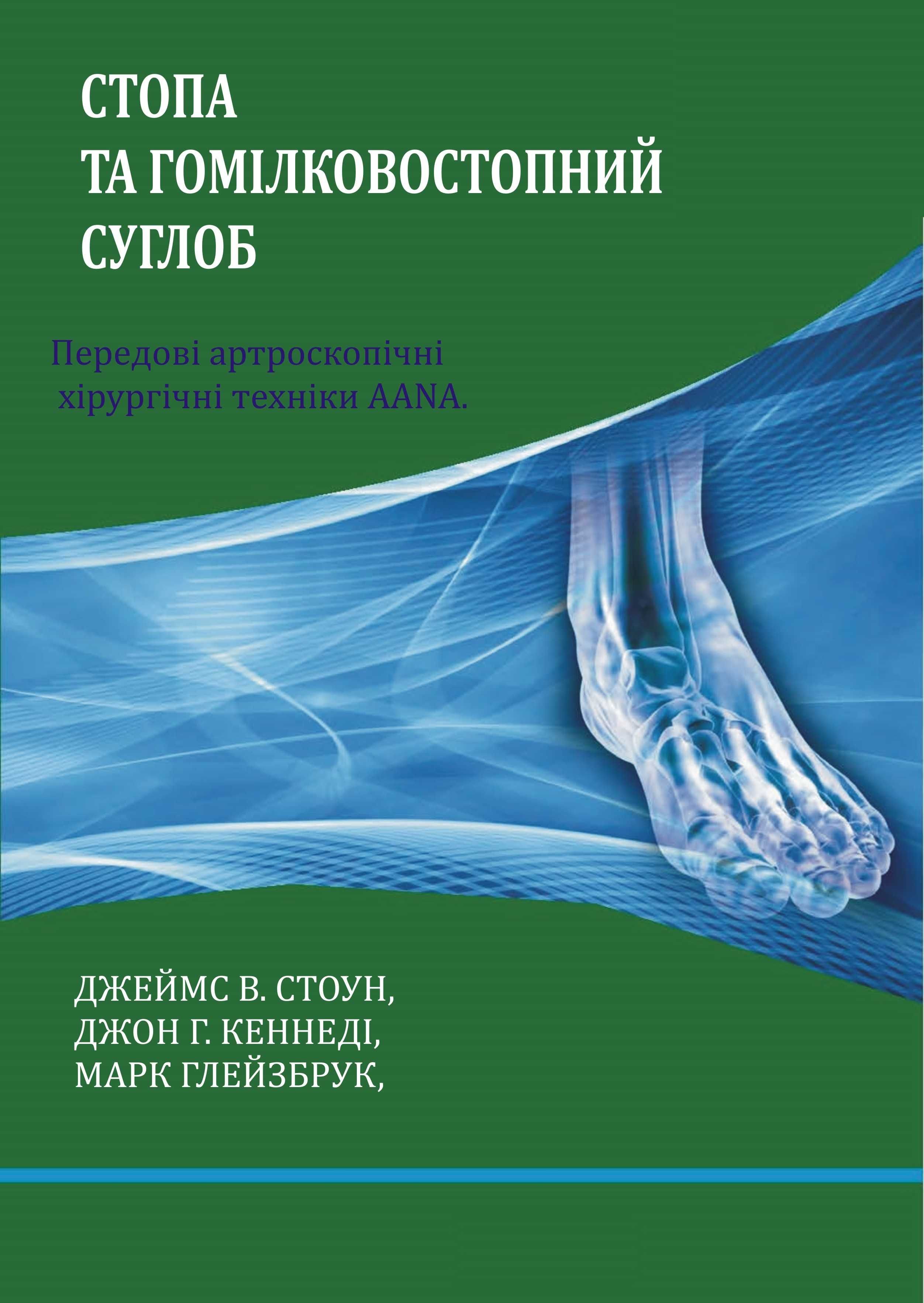 Передові артроскопічні хірургічні техніки