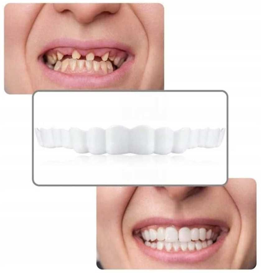 Zdejmowane licówki do zębów