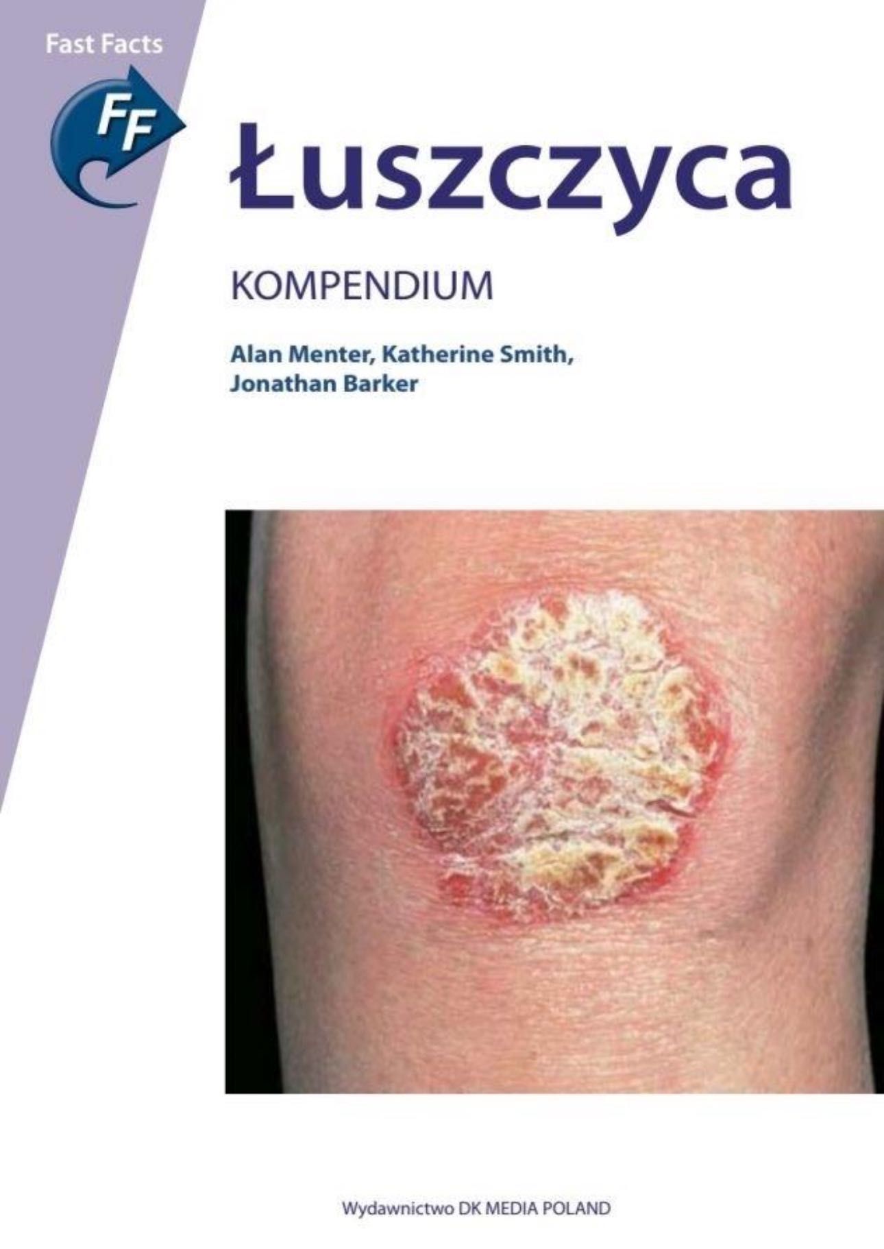 Książka Łuszczyca Kompendium dermatologia