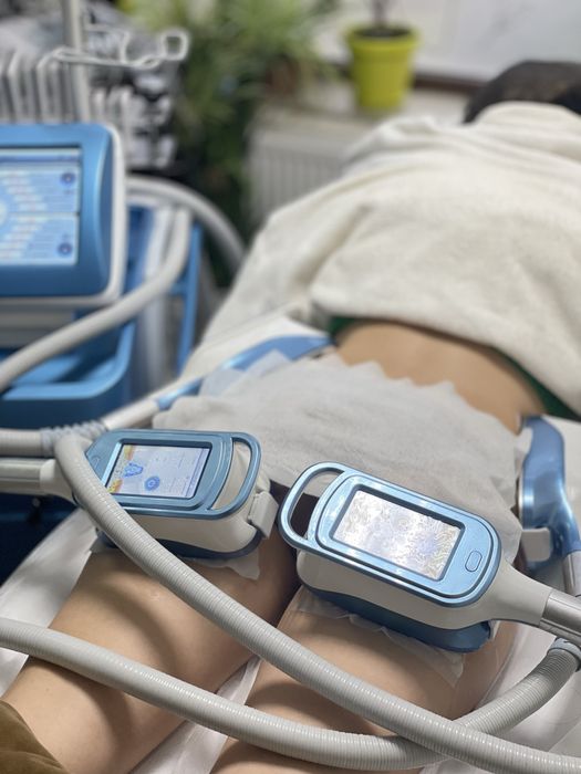 Кріоліполіз, кавітація, обгортання, ролик