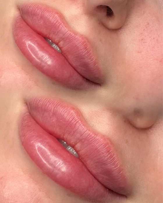 Powieszkanie ust/ BTX