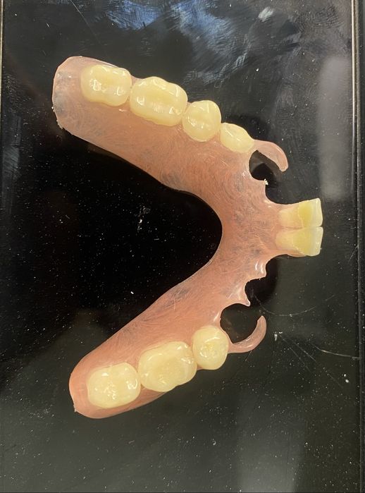 Confeccao de protese em geral