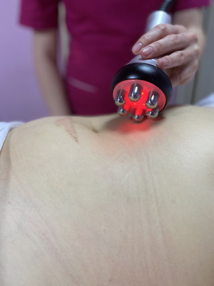 Навчання на антицеллюлітний масаж  одеська харків