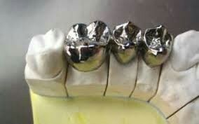 Зубной Техник . Зуботехническая Лаборатория .  МК .ЦИРКОН .