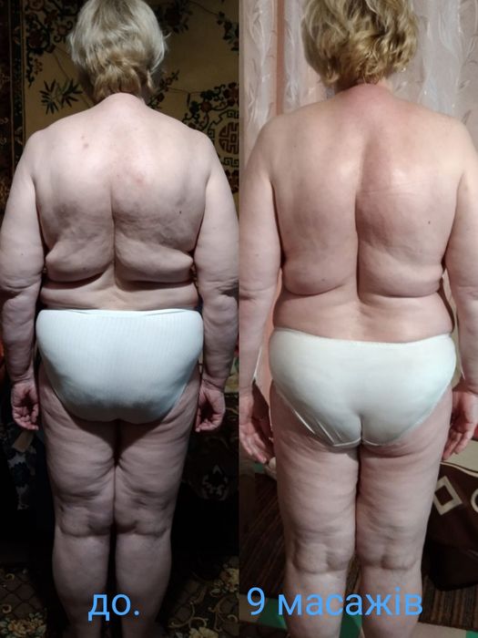 Костоправ. Масажист. Реабілітолог.Вісцеральний тарапевт. Масаж обличчя