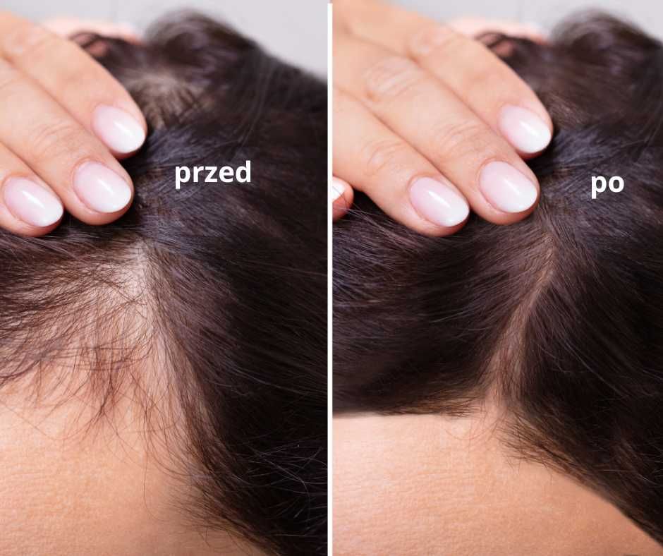 olejek eteryczny Rozmaryn Rosemary doterra