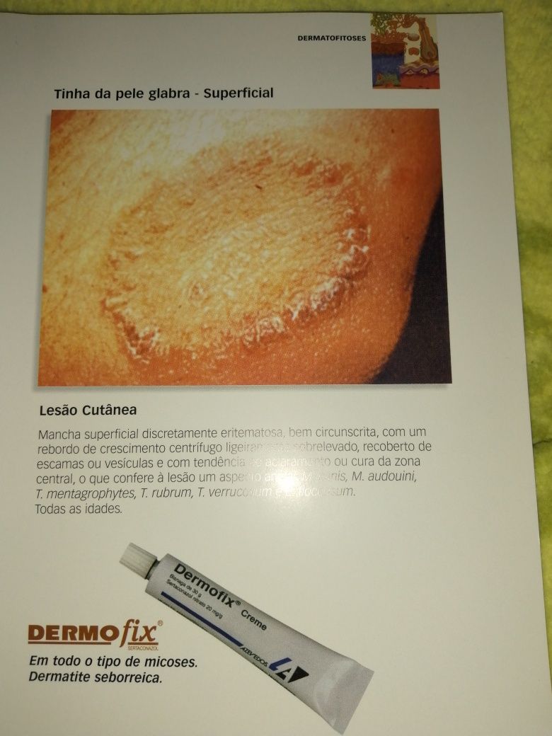 Livro (Dermatomicoses)