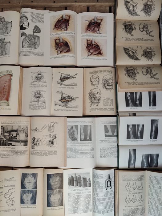 Хирургия Анатомия Пластика Трансплантация органов, тканей, конечностей