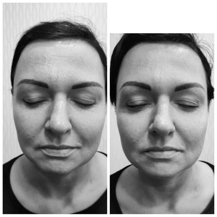 Опытный косметолог | Чистки, пилинги, инъекции